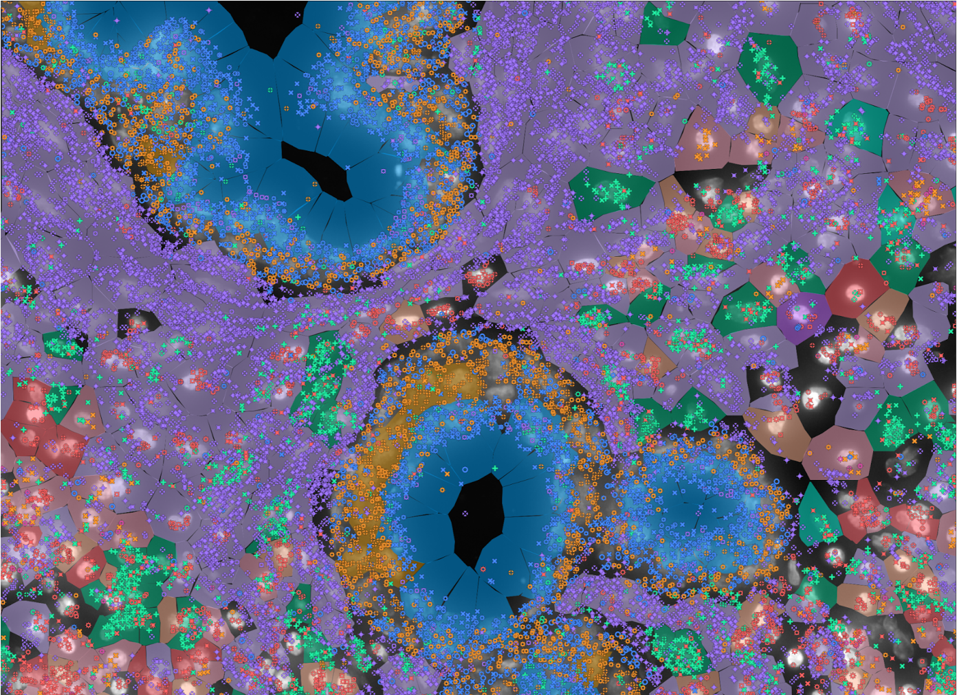 Spatial Transcriptomics